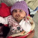 תינוקת סורית במרכז הרפואי זיו בצפת